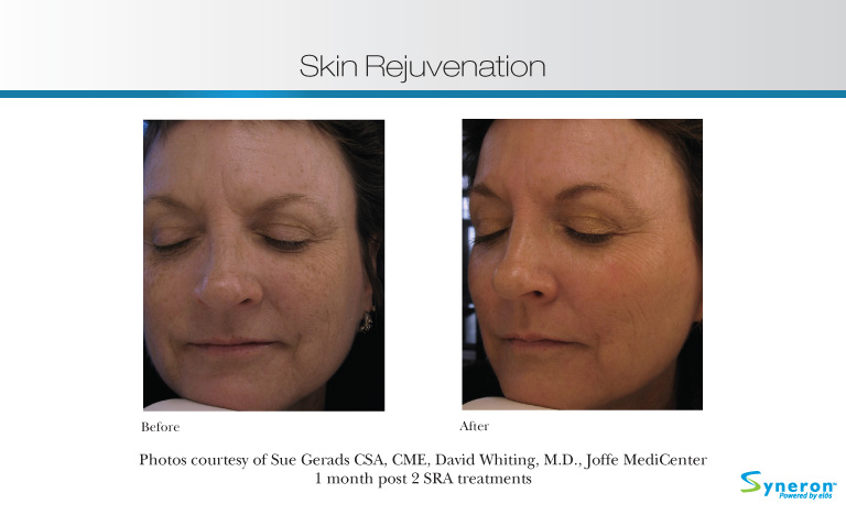 ba_sra_gerads_whiting