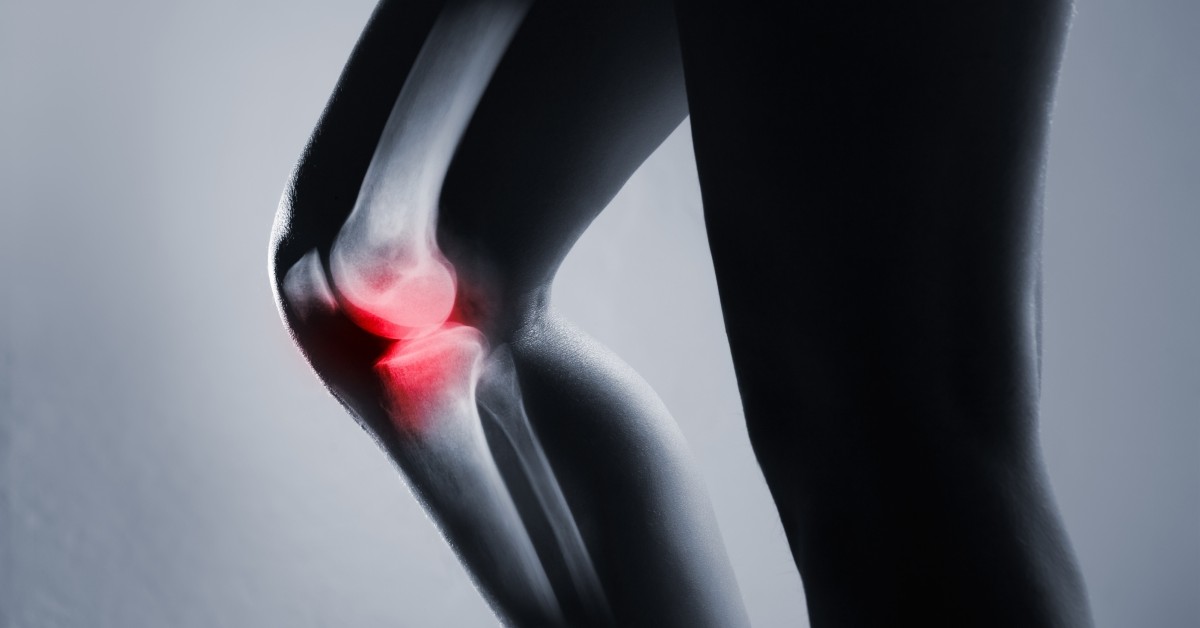 StemCellTherapyArthritis-5d31d7930583c