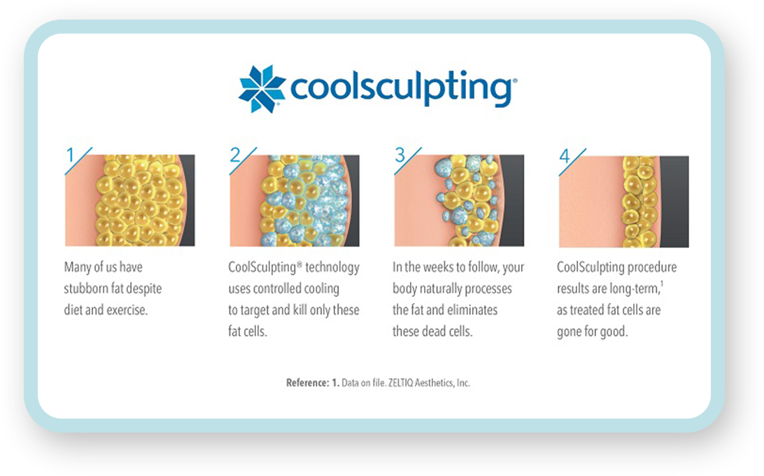 SMOL-IllustrationProcess-H-hires-Web-Graphic-5e6ba8fad720d