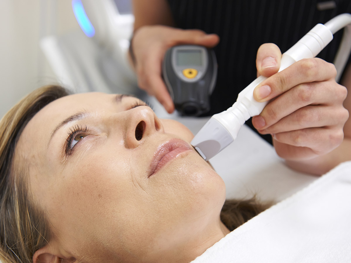 Image of a woman receiving an ultherapy treatment. 