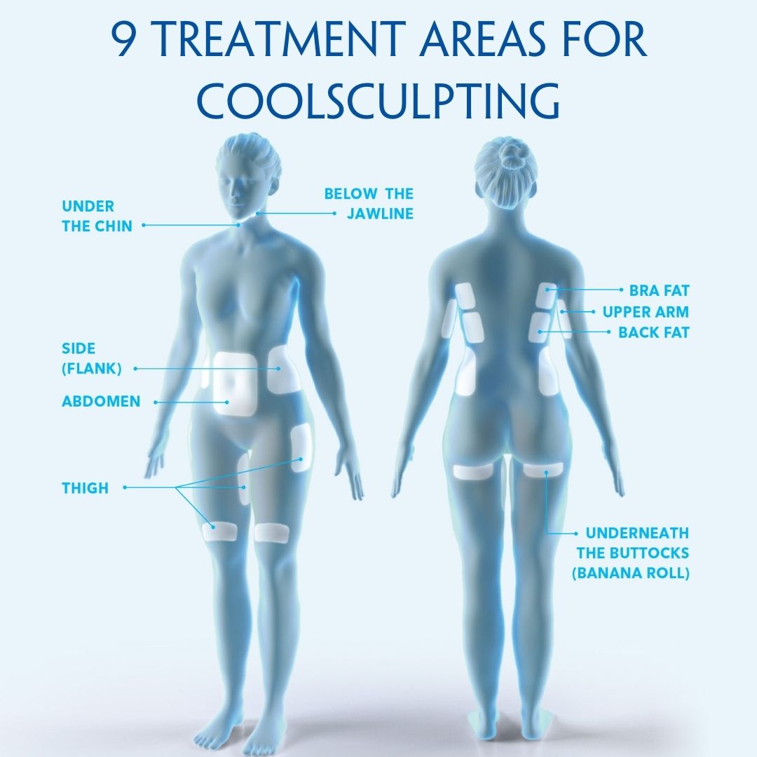 9 Treatments Areas of CoolSculpting