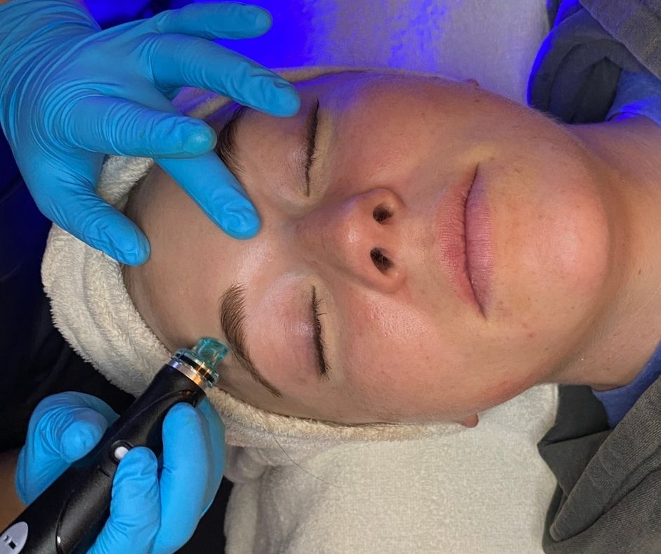 HydraFacial Dani
