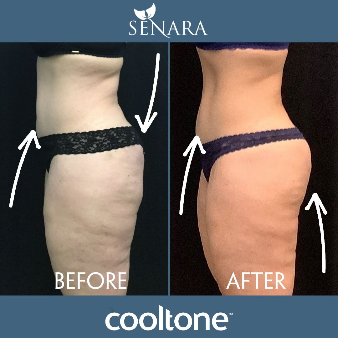 Penny CoolTone Results