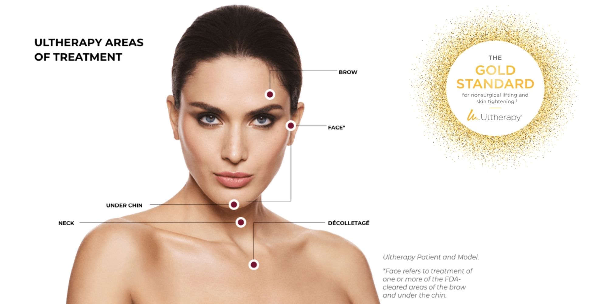 Ultherapy areas of treatment