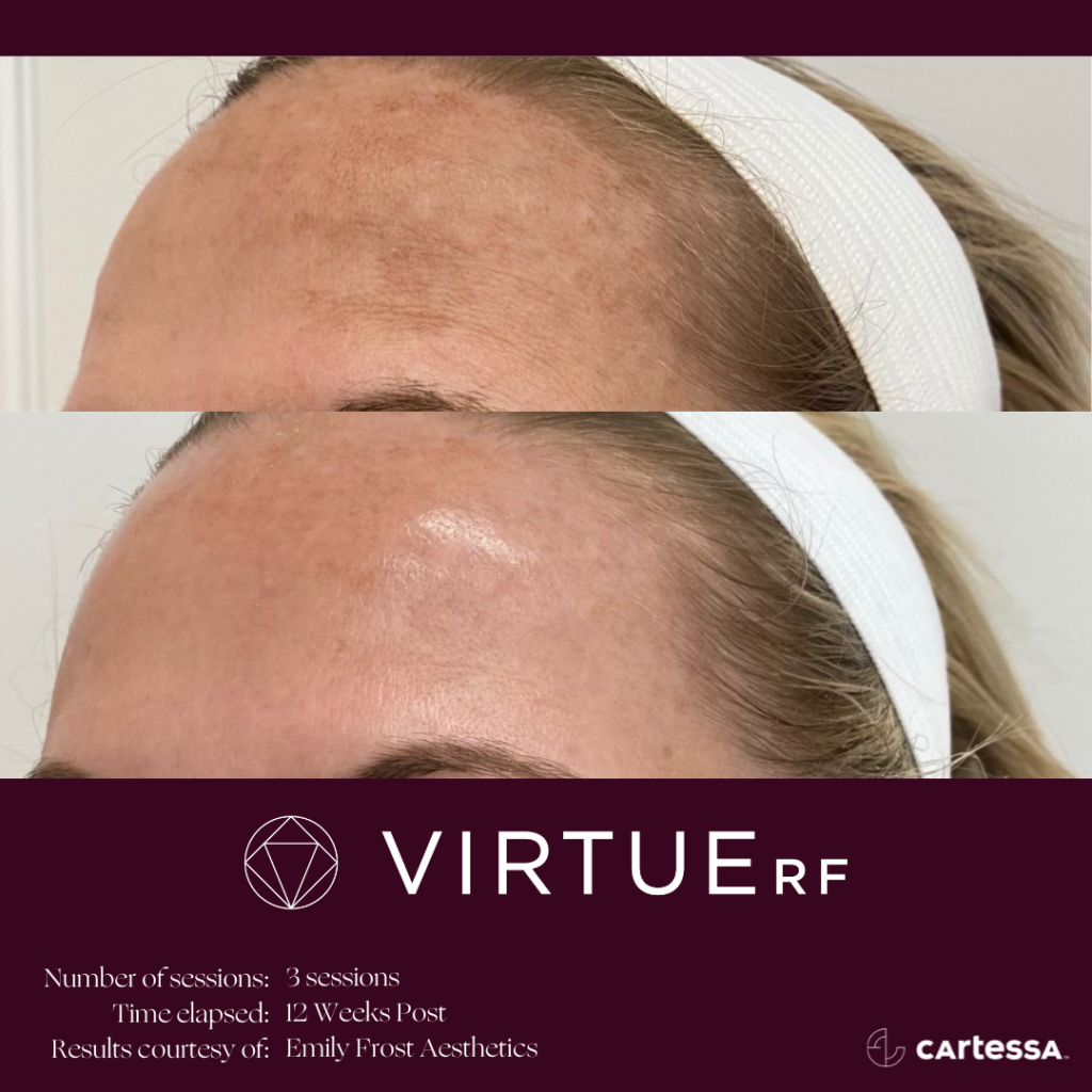 VirtueRFBAFacePigment1-61ae4d1c28e21