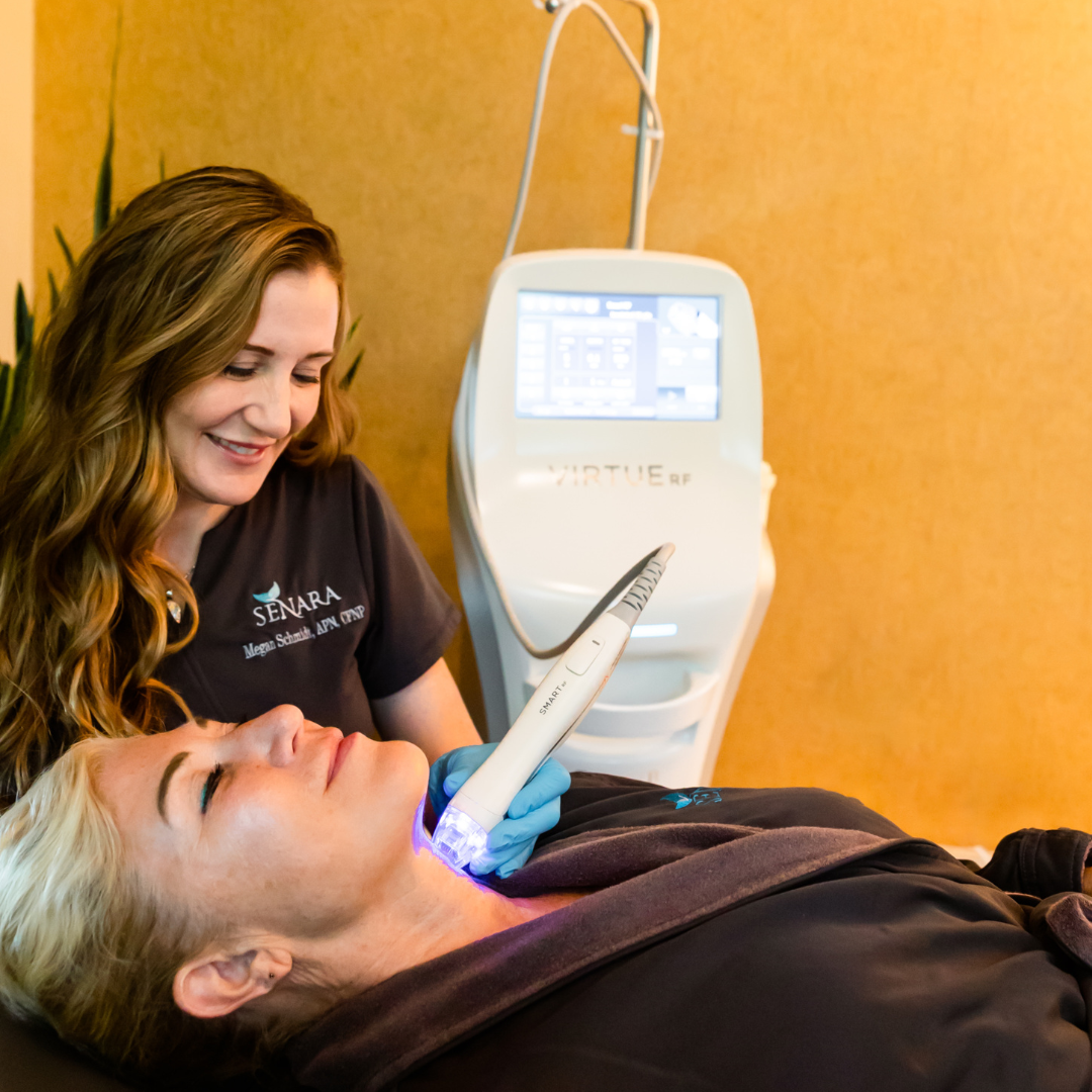 Virtue RF Microneedling