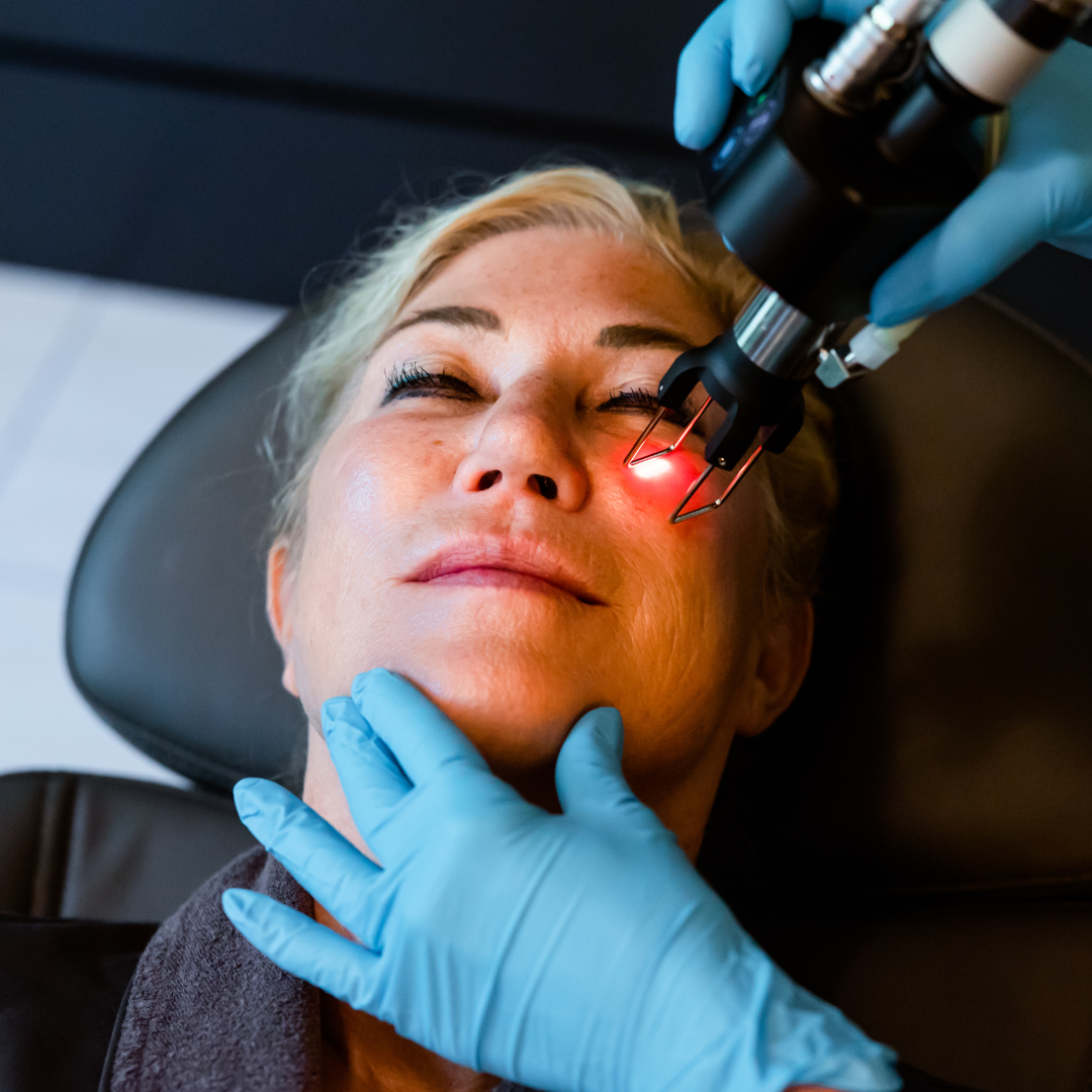 Tetra Cool Peel