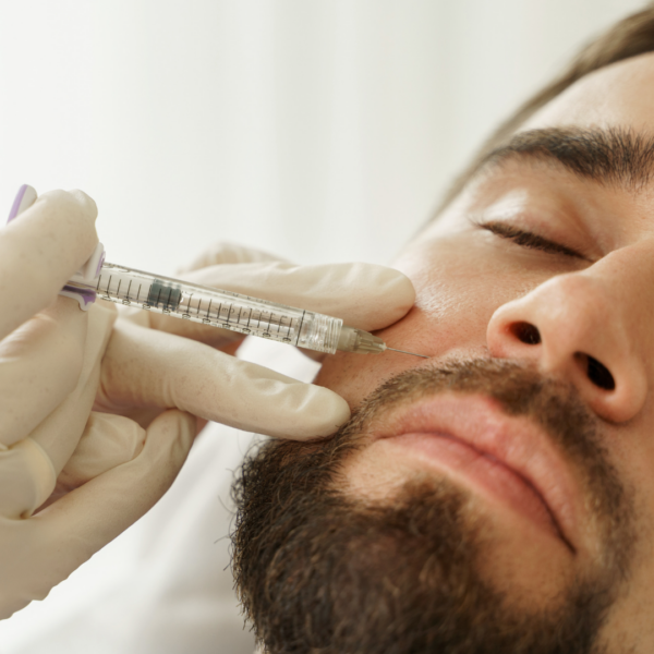 Man getting Sculptra treatment