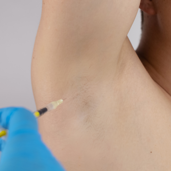 Person getting botox injections in the armpit