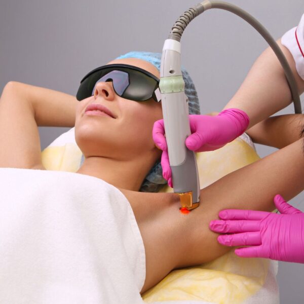 Woman getting laser hair removal in her armpits. 