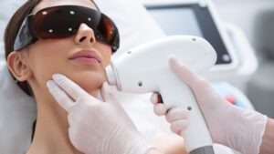 Woman wearing protective glasses getting laser hair removal on her face.