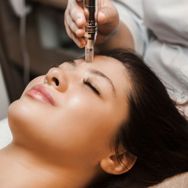 Woman smiling while getting microneedling on her forehead. 