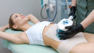 woman getting coolsculpting done