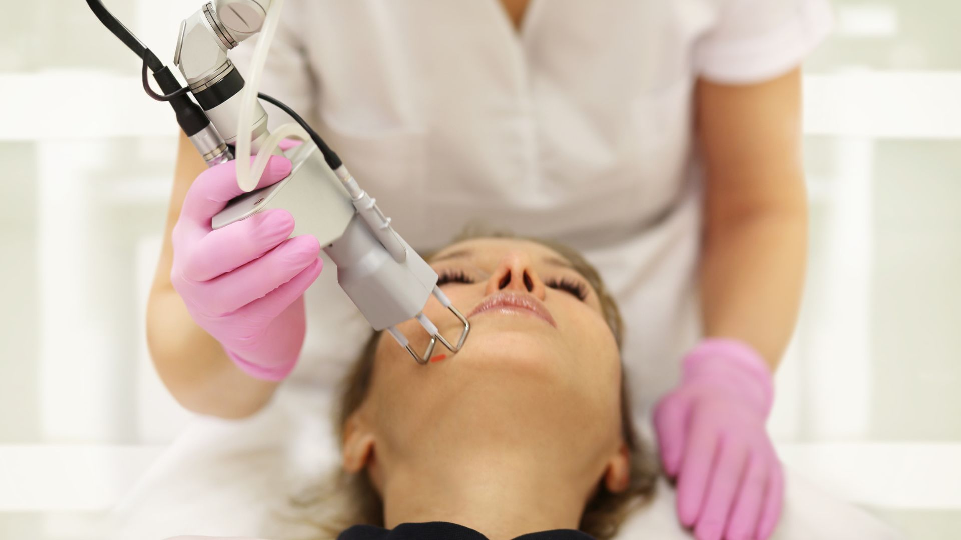 What Are the Top Benefits of Tetra CoolPeel_FT-IMG