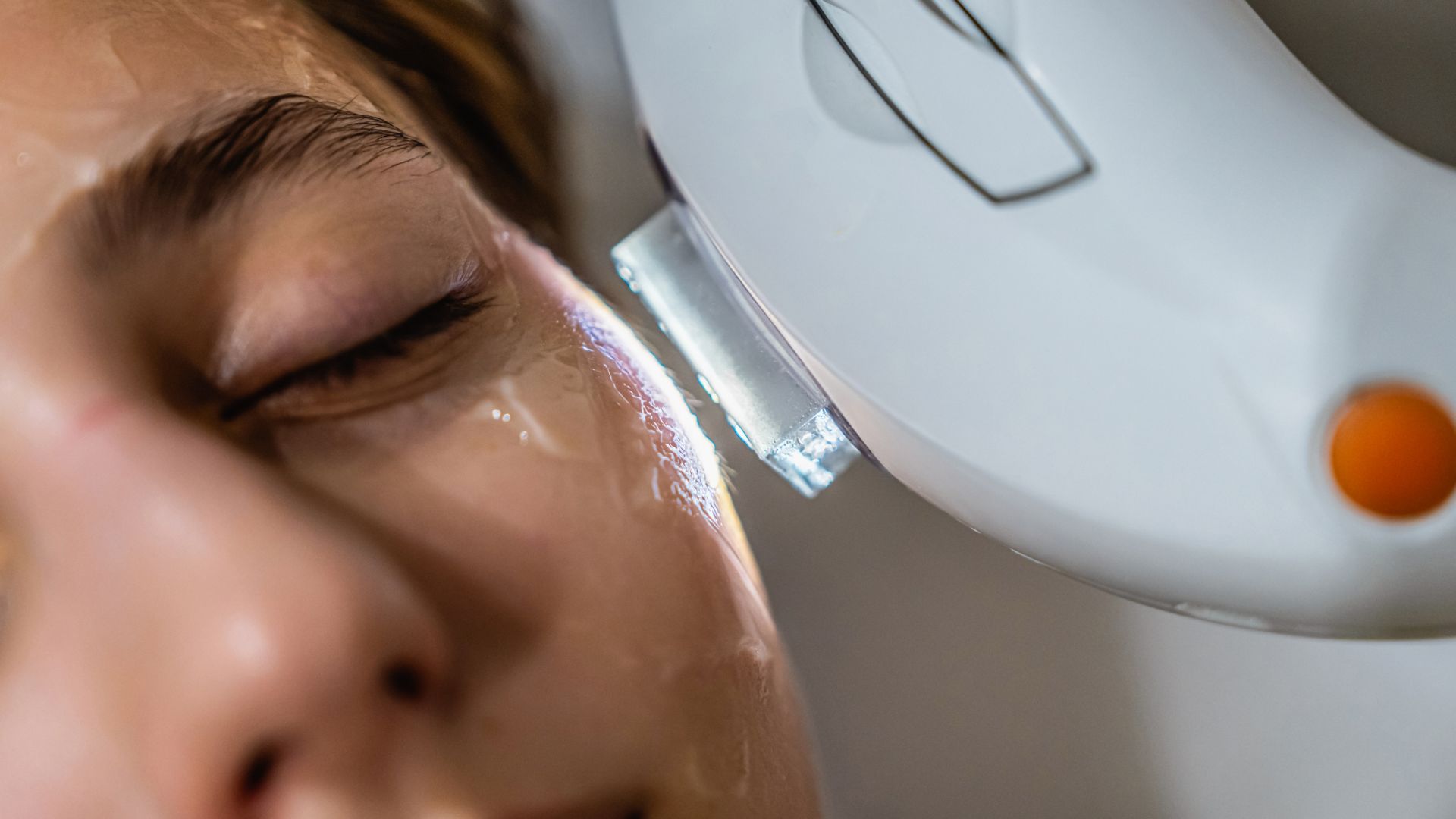Laser treatment.