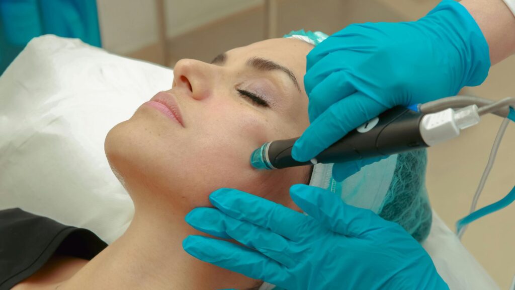 hydrafacial pen used on patient's face, with gloved hands