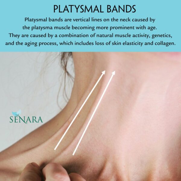 Platysma Muscle