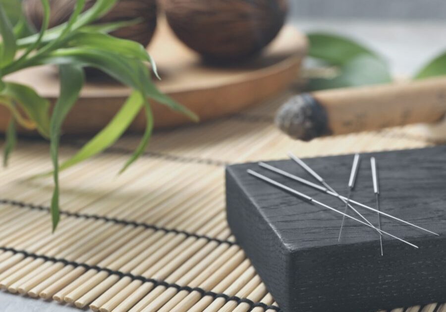 Acupuncture - img2