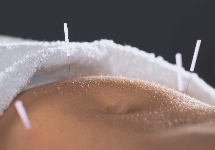 Acupuncture - img3